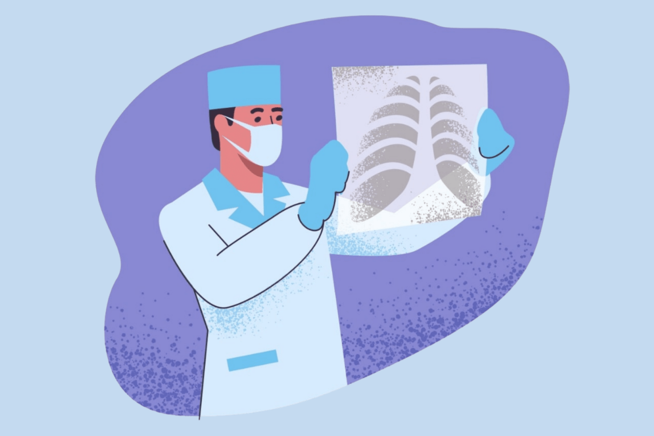 Illustration of doctor looking at x-rays Hollister California